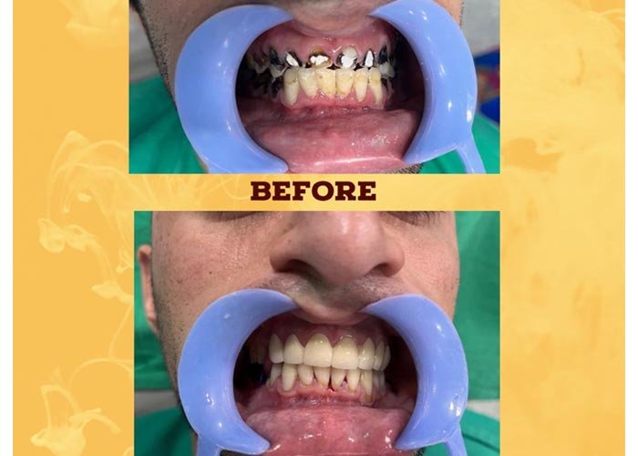 Shankar Dental Clinic, Ramnagar, District - Nainital, Uttarakhand, India