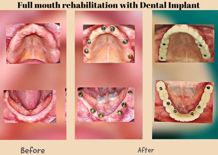 Shankar Dental Clinic, Ramnagar, District - Nainital, Uttarakhand, India